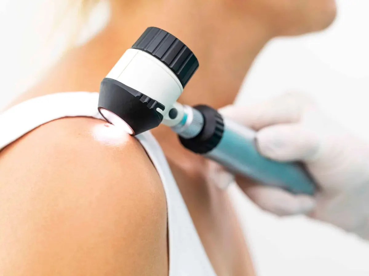 Stock photograph of models: a gloved clinician holds a dermatoscope against a woman's shoulder