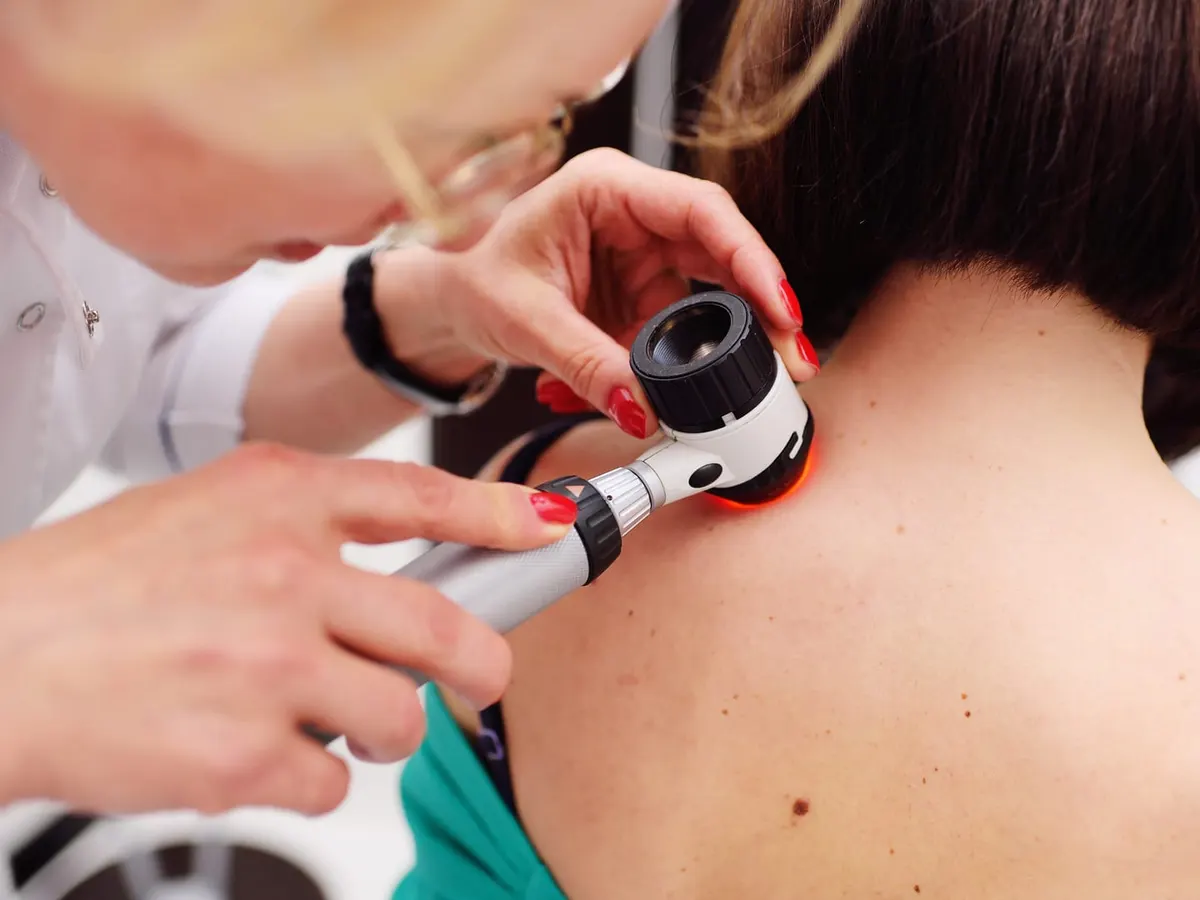 Stock photograph of models: a clinician examines a mole on a woman’s neck with a dermatoscope