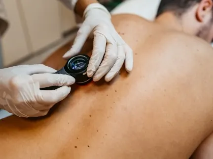 Stock photograph of models: a gloved clinician examines the skin of a man's back with a dermatoscope