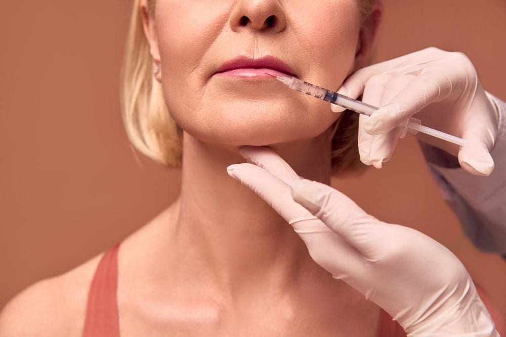 Stock photograph of a model: woman getting juvederm lip filler after botox cosmetic