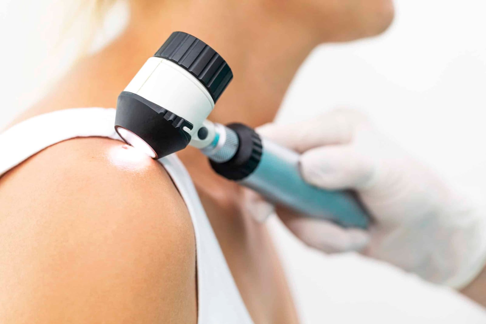 Stock photograph of models: a gloved clinician holds a dermatoscope against a woman's shoulder