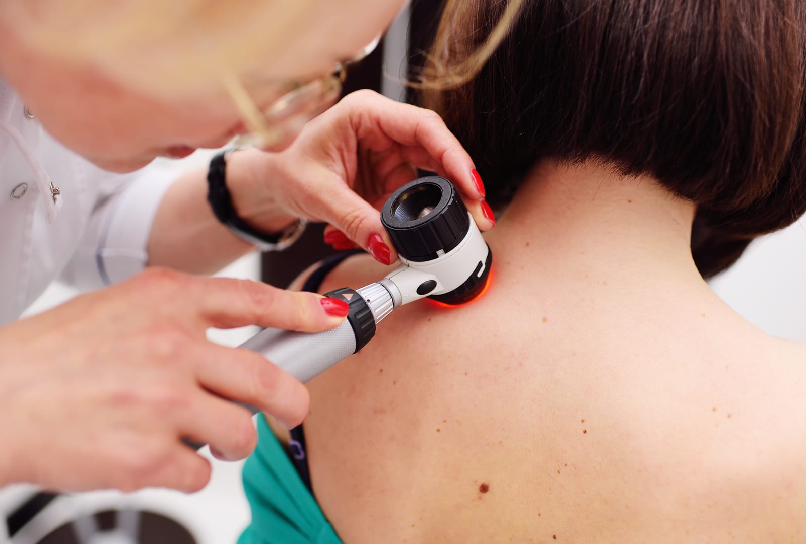 Stock photograph of models: a clinician examines a mole on a woman’s neck with a dermatoscope