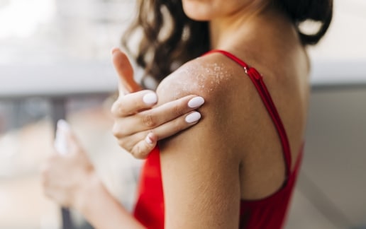 Stock photograph of a model: a woman in a red top touches dry, flaking skin on her shoulder
