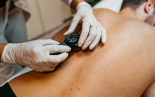 Stock photograph of models: a gloved clinician examines the skin of a man's back with a dermatoscope